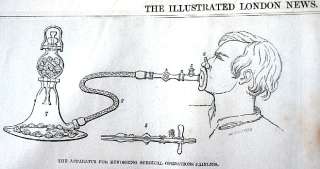 ether apparatus